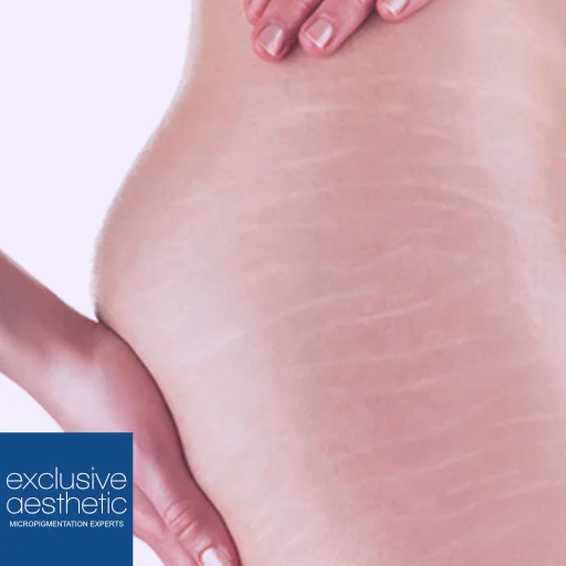 What is MCA - Multitripanic Collagen Actuation? What is MCA - Multitripanic Collagen Actuation? Discover MCA, uncover its benefits, applications, and why it's becoming a beauty game-changer.
