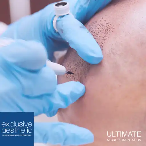 Scalp Micropigmentation Training Course UK Micropigmentation Training Courses UK. Learn to the highest industry standards with Candice Watson, who has 35+ years of teaching experience.