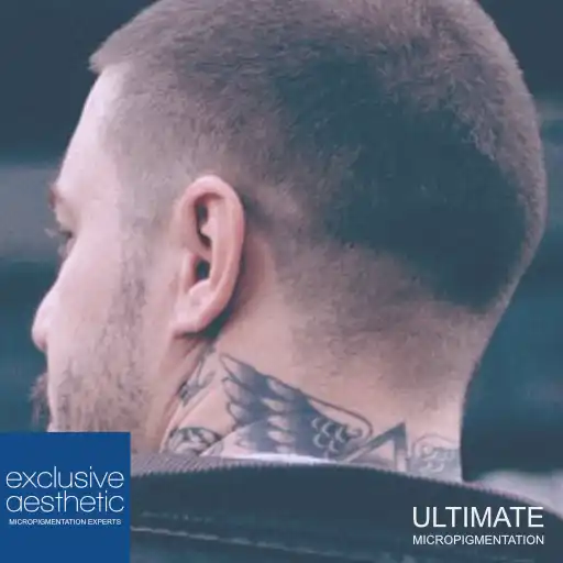 How To Become A Tattoo Removal Technician In The UK. This guide explores the intricacies of becoming a tattoo removal technician in the UK.